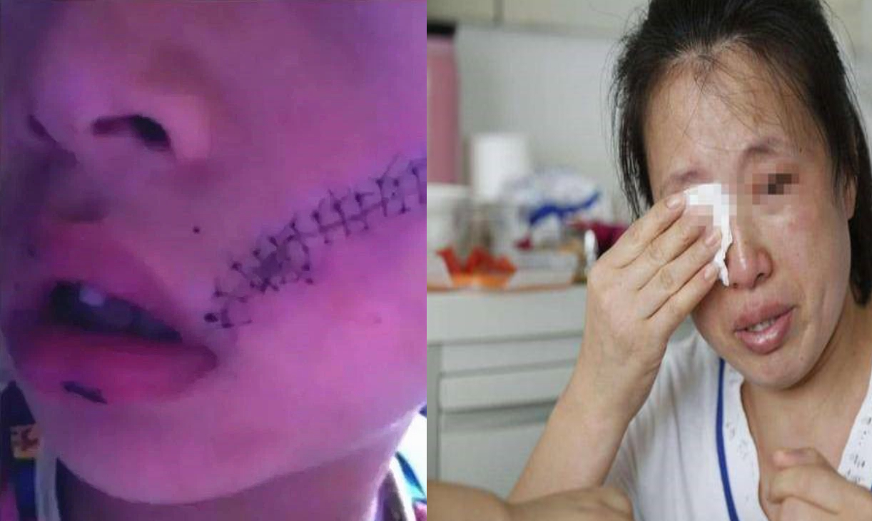 Chi tiết về sự cố